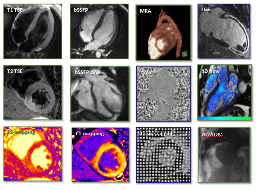 Cardiac MRI Database