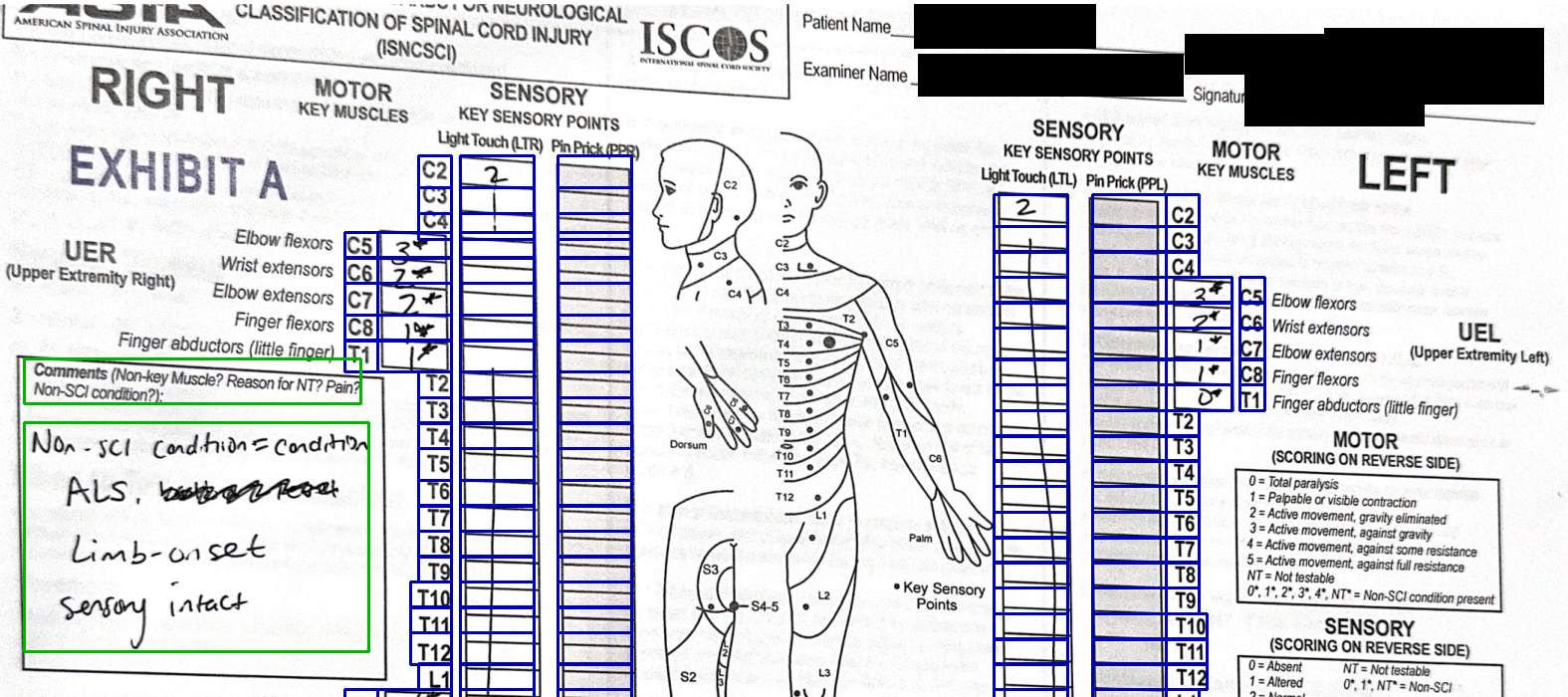 A fictional ISNCSCI worksheet with a tight blue box around each extracted value in the right and left motor and sensory columns; the patient name, examiner, signature and exam date are redacted in black.